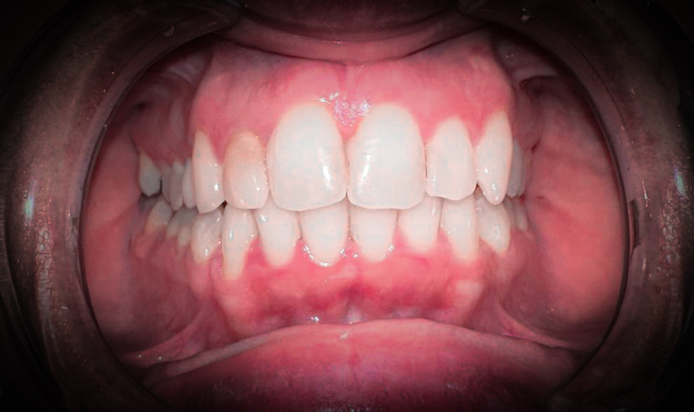 Smilezor1 1